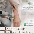 Precision Diode Laser Hair Removal for Hands: A Scientific Approach at Derma & Dental Clinic Online Sale