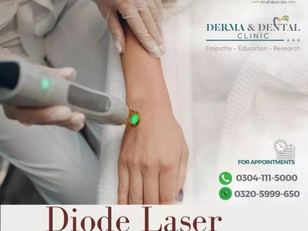 Precision Diode Laser Hair Removal for Hands: A Scientific Approach at Derma & Dental Clinic Online Sale