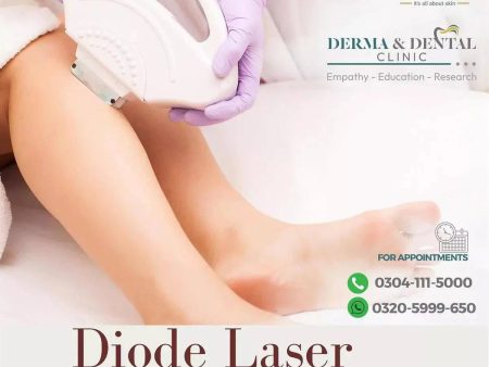 Precision Diode Laser Hair Removal: Half Legs till Knees - Derma & Dental Clinic Hot on Sale