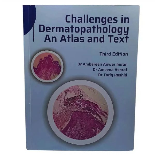 Challenge in Dermatopathology: An Atlas and Text (Third Edition) For Sale