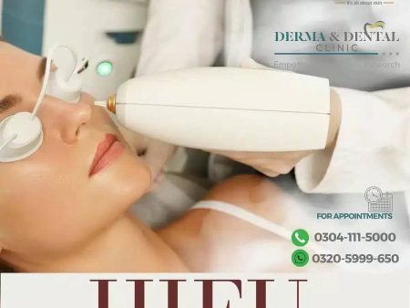 Discover Youthful Radiance with HIFU Skin Rejuvenation at Derma & Dental Clinic Supply