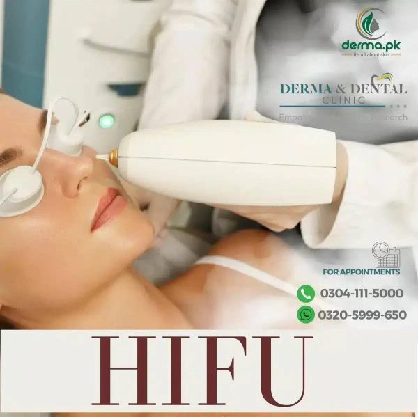 Discover Youthful Radiance with HIFU Skin Rejuvenation at Derma & Dental Clinic Supply