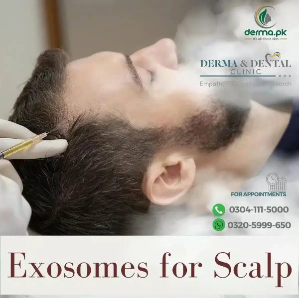 Advanced Scalp Rejuvenation: Exosome Therapy at Derma & Dental Clinic Online Hot Sale