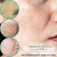 Erase Acne Scars and Unveil Your Radiant Skin: Derma & Dental Clinic s Expert Solutions For Sale