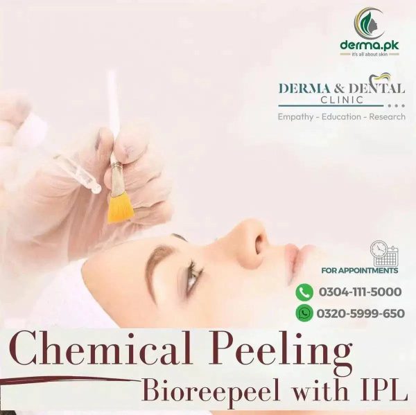 Enhance Your Skin with Chemical Peeling Bioreepeel and IPL - Derma & Dental Clinic Online Sale