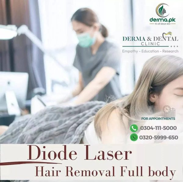 Advanced Diode Laser Hair Removal: Expert Dermatologist Services at Derma & Dental Clinic, Bahria Town Lahore Online Hot Sale