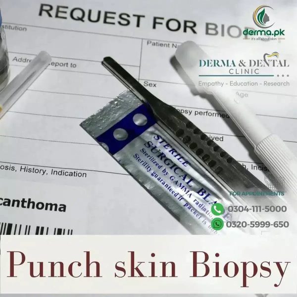 Punch Skin Biopsy: Derma & Dental Clinic s Comprehensive Procedures on Sale