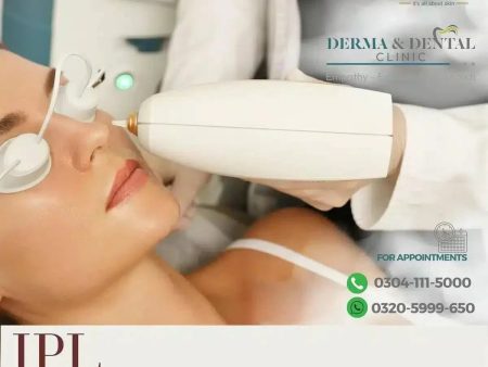 The Science of Radiance: IPL Photofacial and Rejuvenation at Derma & Dental Clinic Online