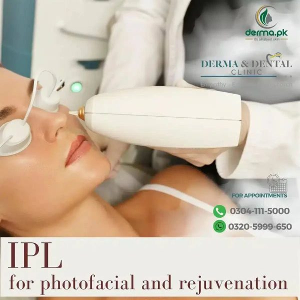 The Science of Radiance: IPL Photofacial and Rejuvenation at Derma & Dental Clinic Online