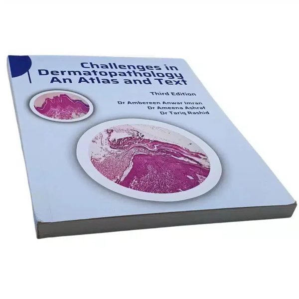 Challenge in Dermatopathology: An Atlas and Text (Third Edition) For Sale