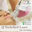 The Science of Flawless Skin: QSwitched Laser Treatment for Freckles at Derma & Dental Clinic Cheap