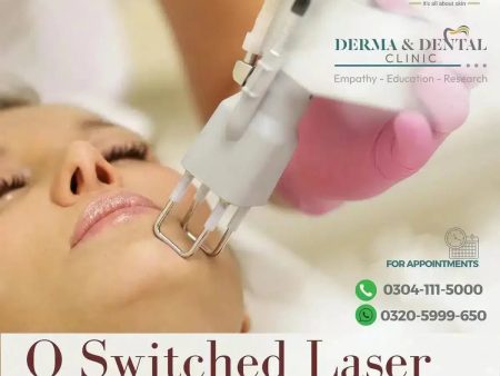 The Science of Flawless Skin: QSwitched Laser Treatment for Freckles at Derma & Dental Clinic Cheap