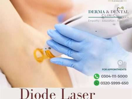 Advanced Diode Laser Hair Removal for Armpits at Derma & Dental Clinic Hot on Sale